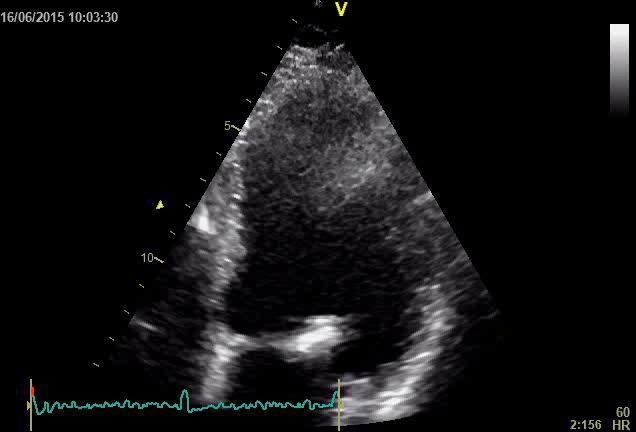 46% SV 50 ml 12 m.