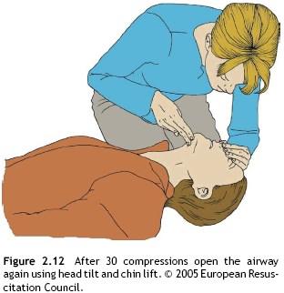 Dopo 30 compressioni (in 18 secondi), iperestendere nuovamente il capo, chiudere il naso tra l indice e il medio della mano posizionata sulla fronte dell infortunato, inspirare normalmente, porre le