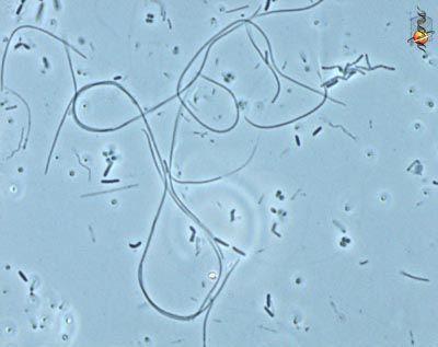 Fibrobacteres/Bacteroidetes/Cytophaga Bacteroides: anaerobi,