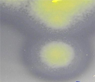 Flexibacter, Cytophaga: comuni negli ambienti acquatici
