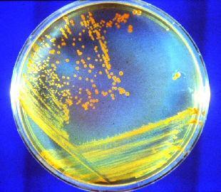 Deinococcus/Thermus (IV) incredibilmente radioresistente (oltre 6 Mrad: una quantità di