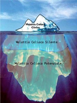 FORMA CLASSICA: 6 mesi 2 anni, con l introduzione del glutine nella dieta. Sintomi: scarsa crescita, diarrea cronica, distensione addominale, ipotonia muscolare, astenia, inappetenza ed irritabilità.