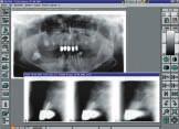 del valore kv Correzione impostazioni per anomalie dei denti frontali Comodità nei comandi: Guide luminose, rapido posizionamento paziente Comode regolazioni motorizzate Sezioni