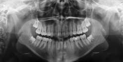 SIDEXIS è il software multifunzionale per tutti i processi di diagnostica per immagini Sirona: radiologia endorale, panoramica, teleradiografia e telecamera endorale.