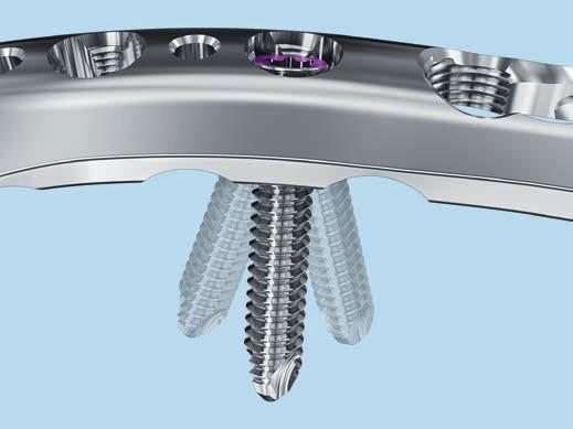 Placche VA-LCP 2.7/3.5 per omero distale. Il sistema di fissazione a basso profilo con tecnologia di bloccaggio ad angolo variabile.