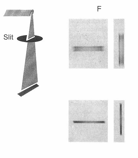 Slit camera La slit camera consiste di una lastra di materiale radioopaco (spesso tungsteno) con una sottile fessura, tipicamente larga 10 µm La mirura della larghezza della distribuzione sull