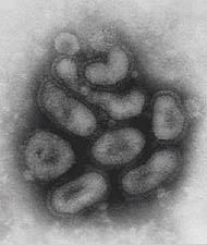 Viral micrographs To the left is an electron micrograph of a cluster of