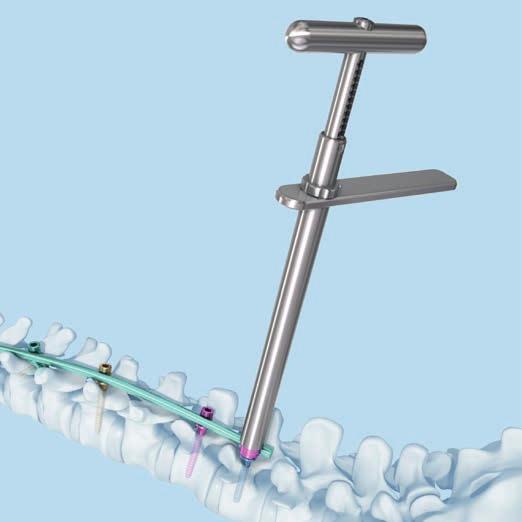 (vite o uncino). 3. Serrare il dado in modo che possa essere svitato manualmente Serrare il dado con la chiave a tubo per dado dodecagonale con impugnatura ad L.