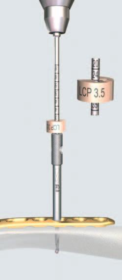 027) nel foro centrale filettato della placca. 2 Pre-forare il foro della vite Punta elicoidale LCP da 2.8 mm, lunghezza 165 mm, con due scanalature, per innesto rapido 310.