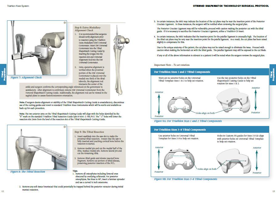 Sistemaprotesico di ginocchio Triathlon PROTOCOLLO CHIRURGICO TECNOLOGIA OTISMED SHAPEMATCH Preparazionede lla tibia Fase 8: Controllo dell allineamento extramidollare 1.