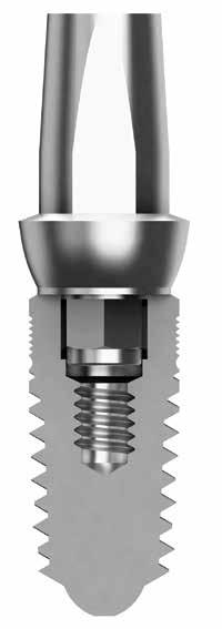 59 Il Sistema Implantare IHT IHT impiega profili emergenti anatomici e permette il platform shifting come soluzione protesica con un accoppiamento su spalla a 30 Soluzioni protesiche adatte a tutte