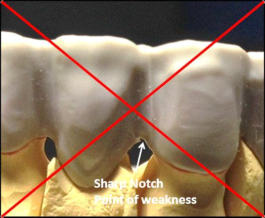 Suggerimenti di costruzione importanti per strutture in JUVORA PEEK Tacche dai bordi taglienti nella struttura: Evitare sempre tacche taglienti nella struttura.