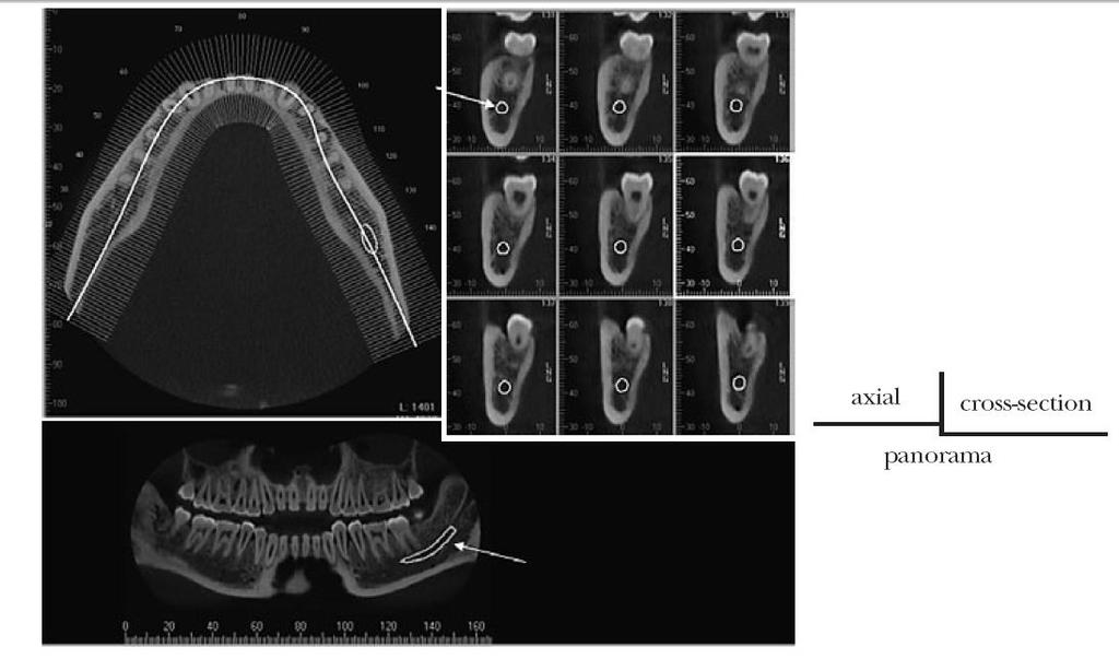 CBCT