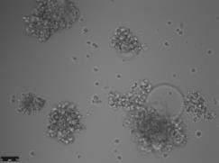 Metodi di laboratorio per la diagnosi di infezioni da virus del Morbillo e della Rosolia Diagnosi molecolare Real-time RT-PCR in house nel tampone faringeo, saliva,urine (Test accreditato con Ente