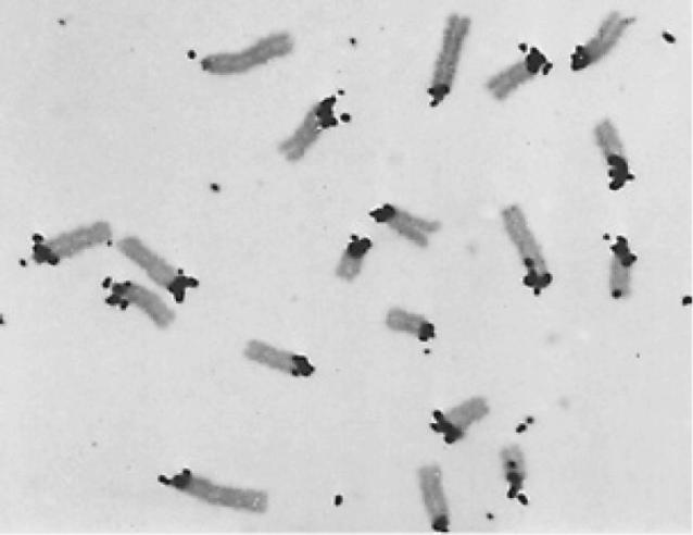 nelle regioni dell ETEROCROMATINA