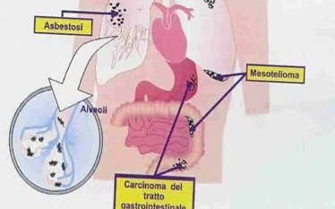 sull apparato respiratorio una serie