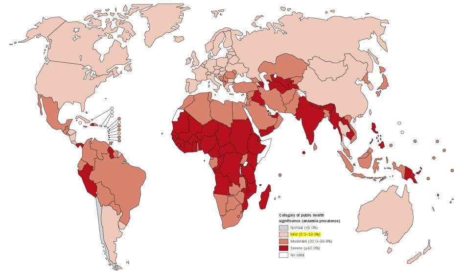 Prevalenza globale dell anemia Il 24,8% della