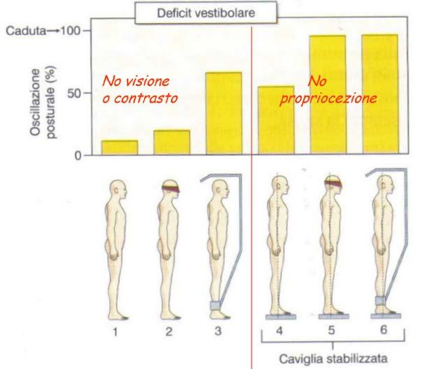 Come si fa a studiare il contributo del visivo? È sufficiente bendare o mettere al buio il soggetto ed andare a calcolare l area di oscillazione (diventa più grande).