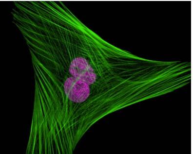 Citoscheletro Microfilamenti