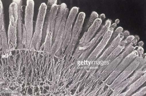 absorptive epithelial cell in the