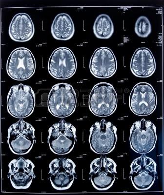 La soluzione Neuronavigatore