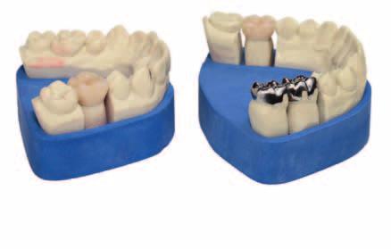 In quanto componente fondamentale del sistema CAD/CAM, i materiali KaVo soddisfano tutti i requisiti per una lavorazione efficiente e qualitativamente eccellente.