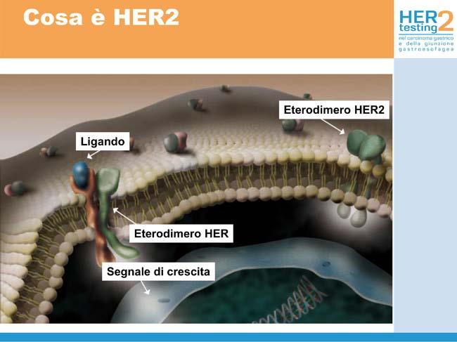 Recettore HER2 HER2 è un recettore tirosin-chinasico di transmembrana con una parte extracellulare, che viene coinvolta nelle vie di trasduzione del segnale che portano alla crescita e al