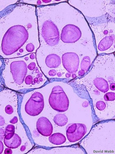 nel golgi delle cellule della cuffia Controlla il gravitropismo