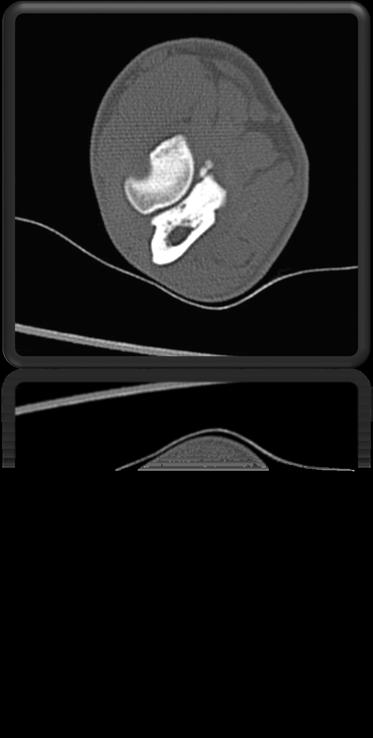 Scheletro appendicolare