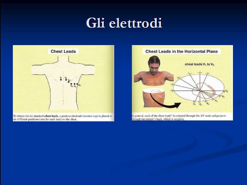 Gli elettrodi precordiali (piano orrizzontale) Per ottenere i sei elettrodi toracici standard l elettrodo positivo viene messo in sei differenti ma precise posizioni