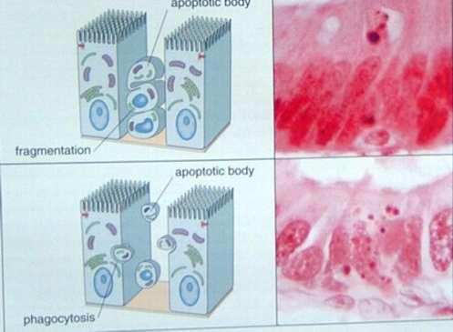 Poiché la riduzione del cellulare e la formazione dei corpi apoptotici è rapida e i frammenti sono rapidamente fagocitati e degradati, può avvenire