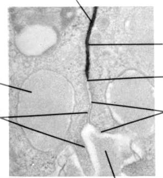 Micrografia elettronica di una sezione di due cellule epatiche a contatto dove sono visibili le giunzioni occludenti (frecce).
