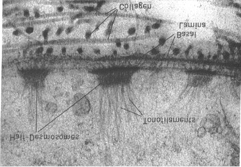 Desmosomi ed emidesmosomi come appaiono in Microscopia elettronica tradizionale