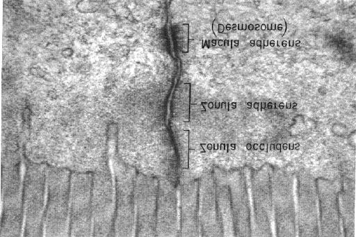 I sistemi di giunzione Micrografia elettronica di una sezione della regione apicale di epitelio intestinale sinonimi Giunzioni occludenti Tight junctions