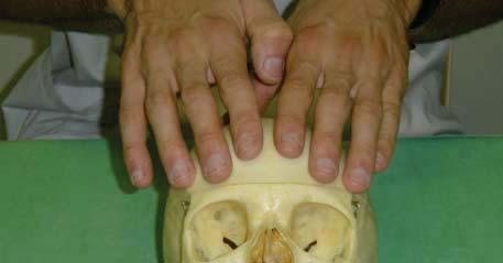 Normalmente: presa con le dita lunghe. Tutte le ossa della faccia sono sospese al frontale.