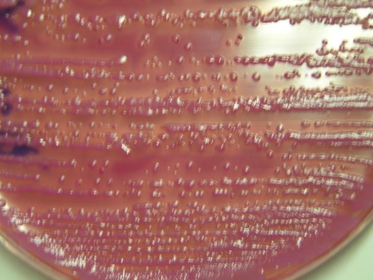 Enterobatteriacee Cristal violetto e sali biliari + rosso neutro + glucosio (VRBGA)