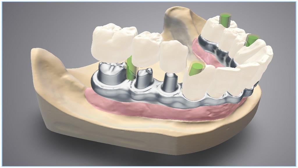 rilasci del sftware Dental Wings DWOS 7.