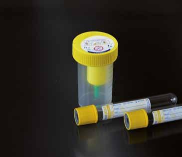 Contenitori per urine graduati fino a 100 ml, tappo a vite giallo con dispositivo per aspirazione con provette sottovuoto. Con etichetta applicata sul tappo per la protezione del sistema di prelievo.