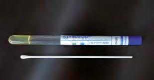 After sampling, swab must be immersed in the culture medium of the test tube and, after an incubation of 18/24 hours, the colour change highlight the presence/absence of the researched contamination.