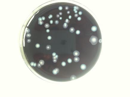 Nel caso di presenza di colonie di Legionella presunte (vedi Allegato 5 della Linee Guida per la prevenzione ed il controllo della legionellosi (79/CSR del 7/5/2015), Identificazione e conservazione