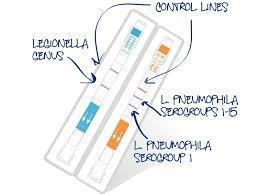 9.3.2 Identificazione Vedi norma ISO 11731:1998 e all Allegato 5 della Linee Guida per la prevenzione ed il