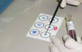 agglutinazione al lattice; agglutinazione diretta su vetrino; test immunocromatografico; immunofluorescenza