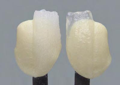 Risultati di cottura Nelle ceramiche dentali il risultato della cottura dipende in larga misura dai cicli di cottura individuali, ed in particolare dal tipo di forno, dalla posizione della