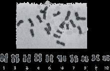 Il cariotipo o mappa cromosomica praticamente consiste nella fotografia dei cromosomi di un individuo.