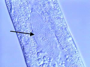 n n Photorhabdus Heterorhabditis n Simbiosi molto specifica, 1 specie di batterio è associata ad 1 sola specie di nematode Xenorhabdus Steinernema n Simbiosi meno specifica, 1 specie di batterio può