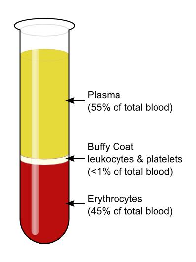 Isolamento del Plasma da sangue periferico 2 tipi di campioni Pazienti β-talassemici con alti livelli di emoglobina fetale Pazienti β-talassemici con bassi livelli di emoglobina fetale Protocollo 1.