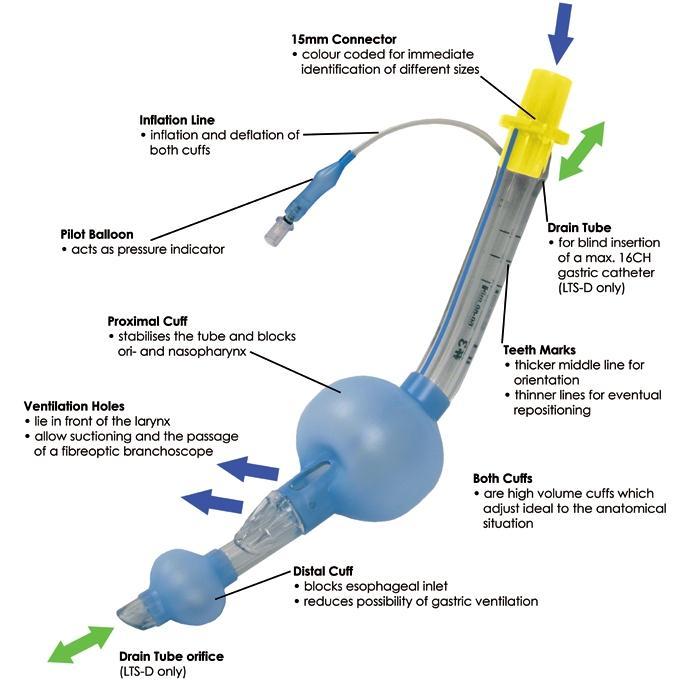 Device per la ventilazione: avanzati Tubo laringeo