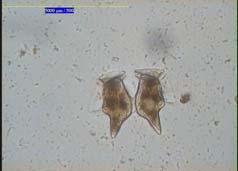 Fitoplancton potenzialmente tossico (cell/l): il fitoplancton è costituito da organismi vegetali, unicellulari o coloniali, microscopici (microalghe) con scarsa capacità di movimento.