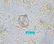 Le specie algali tossiche appartengono principalmente ai gruppi delle Diatomee e delle Dinoflagellate.