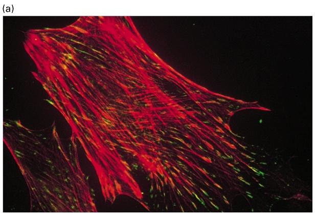 Focal adhesion Actin